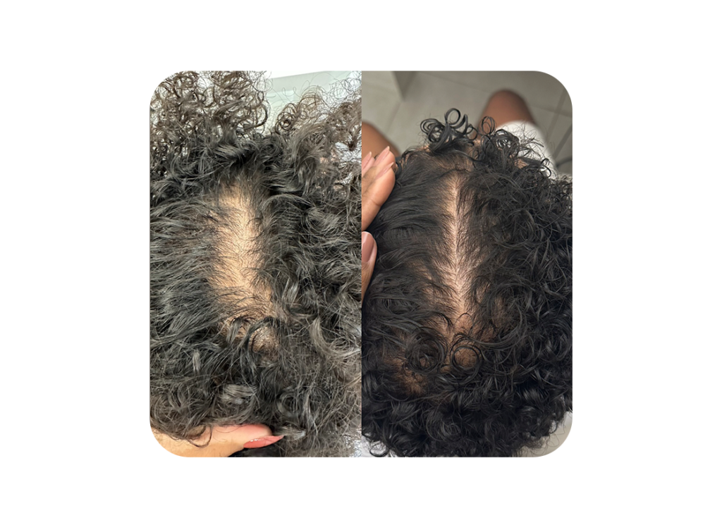 Antes e depois 1