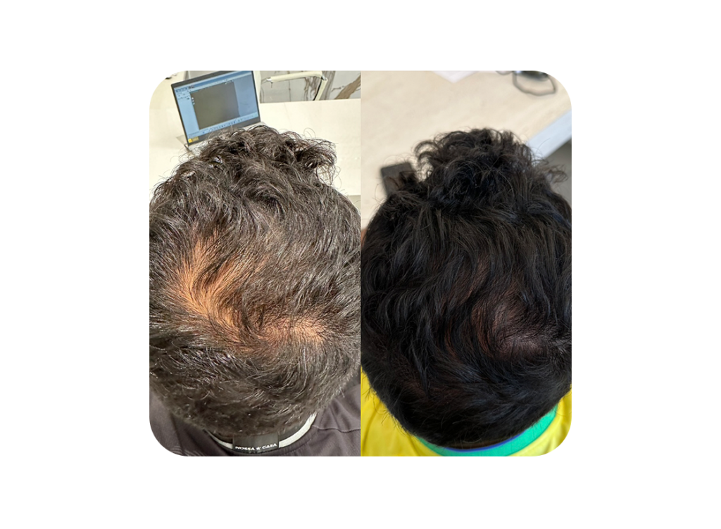 Antes e depois 2