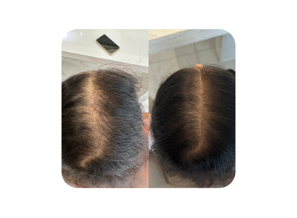Antes e depois 3